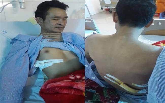 Kẻ dùng dao đâm người cứu nạn có hành vi hết sức côn đồ - Ảnh 3.