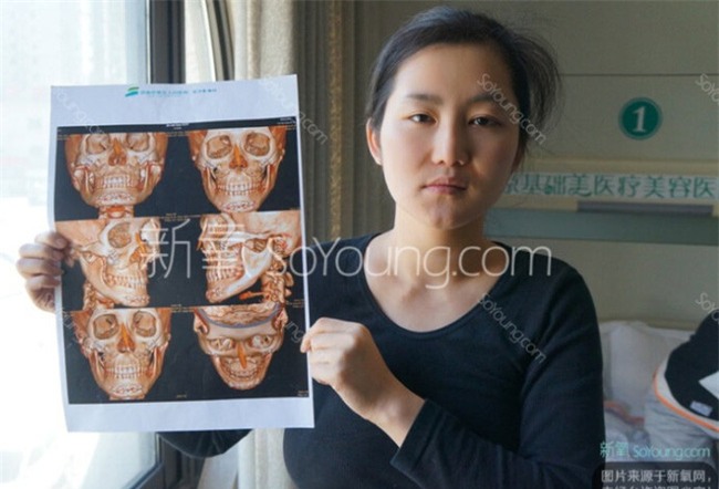 Cô nàng xinh đẹp với 10 lần đập mặt làm lại, đánh đổi 5 năm thanh xuân vật lộn để có khuôn mặt mỹ miều - Ảnh 8.