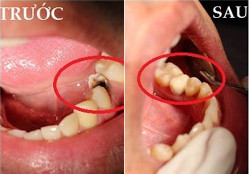 chanh-cao-rang-blogtamsuvn4