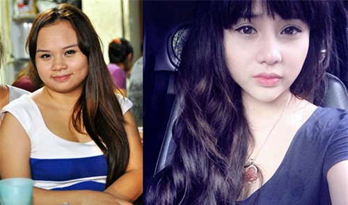 nhung "tin do tham my" viet khien ban soc vi dao keo ca vai chuc lan - 1