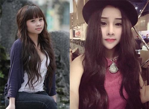 nhung "tin do tham my" viet khien ban soc vi dao keo ca vai chuc lan - 2