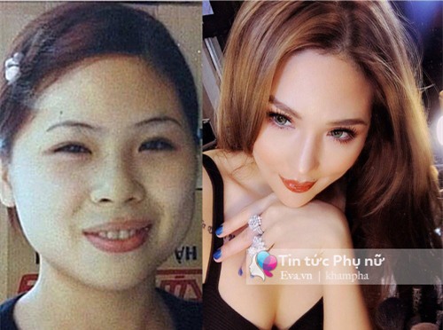 nhung "tin do tham my" viet khien ban soc vi dao keo ca vai chuc lan - 5