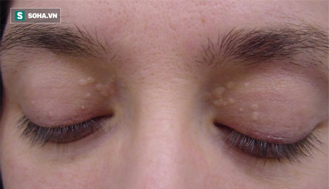 Mắt có một trong các dấu hiệu này, hãy cảnh giác nguy cơ mắc 9 loại bệnh nguy hiểm - Ảnh 1.