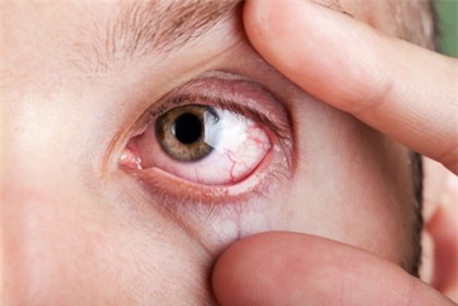 Mắt có một trong các dấu hiệu này, hãy cảnh giác nguy cơ mắc 9 loại bệnh nguy hiểm - Ảnh 2.