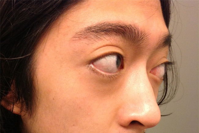 Mắt có một trong các dấu hiệu này, hãy cảnh giác nguy cơ mắc 9 loại bệnh nguy hiểm - Ảnh 3.