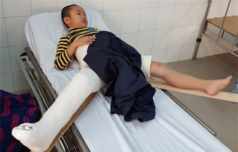 vu hoc sinh gay chan o truong nam trung yen khi su doi tra len ngoi hinh 2