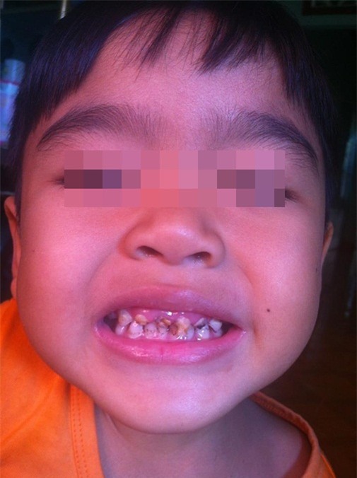 anh-hot-blogtamsuvn.jpg 3