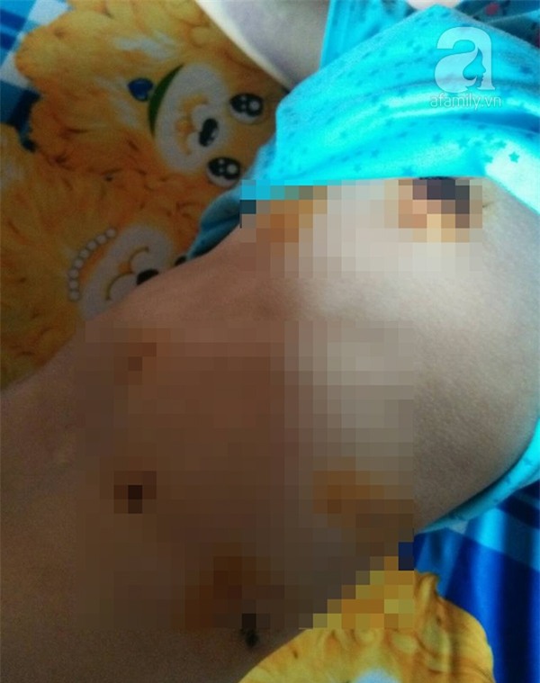 Người vợ trẻ bị bồ của chồng đánh ghen ngược: Nhìn con đòi mẹ mà bản thân bất lực không thể lại gần - Ảnh 1.