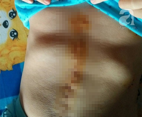 Người vợ trẻ bị bồ của chồng đánh ghen ngược: Nhìn con đòi mẹ mà bản thân bất lực không thể lại gần - Ảnh 2.