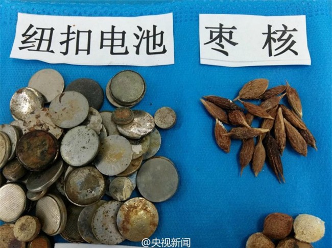 Bạn không thể hình dung được con mình sẽ nuốt phải những gì chỉ sau vài giây bất cẩn - Ảnh 4.