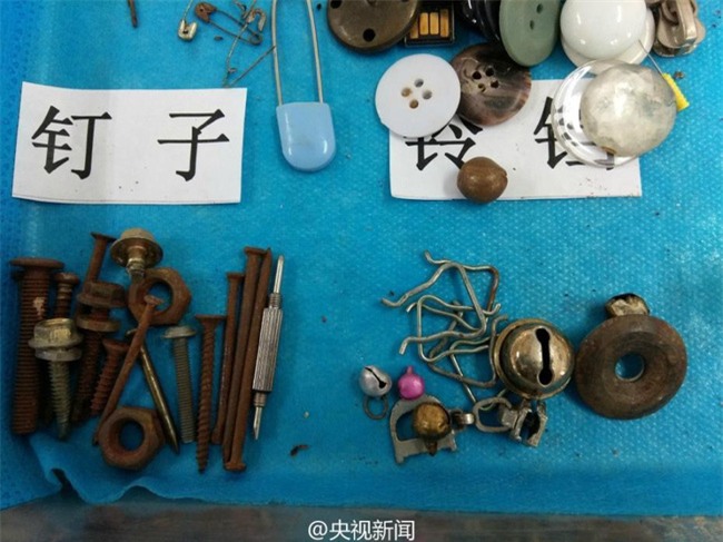 Bạn không thể hình dung được con mình sẽ nuốt phải những gì chỉ sau vài giây bất cẩn - Ảnh 5.