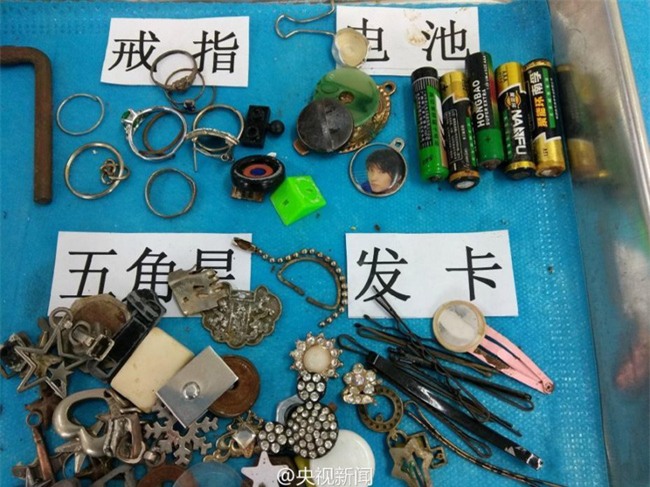 Bạn không thể hình dung được con mình sẽ nuốt phải những gì chỉ sau vài giây bất cẩn - Ảnh 6.