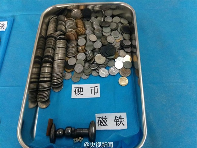 Bạn không thể hình dung được con mình sẽ nuốt phải những gì chỉ sau vài giây bất cẩn - Ảnh 7.