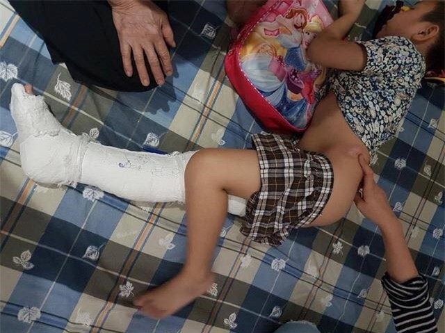 Học sinh gãy chân: Giá như cô hiệu trưởng xuống xe xin lỗi - Ảnh 2.