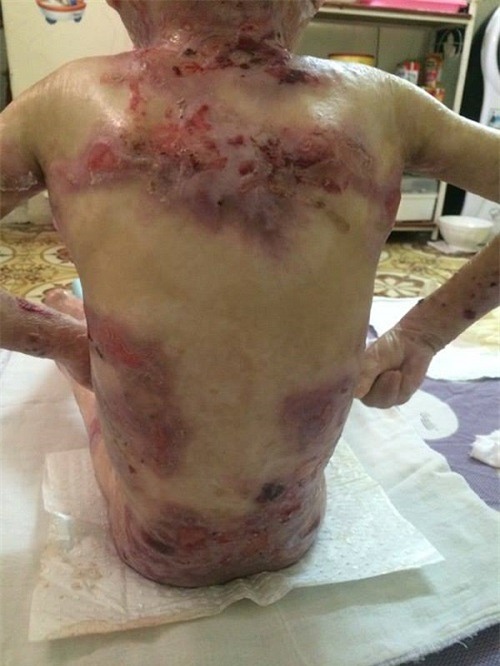 xot thuong be 5 tuoi chi nang 10kg, phai chiu nhung con dau giang xe da thit - 3