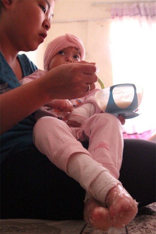 xot thuong be 5 tuoi chi nang 10kg, phai chiu nhung con dau giang xe da thit - 4