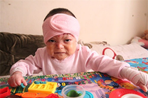 xot thuong be 5 tuoi chi nang 10kg, phai chiu nhung con dau giang xe da thit - 5