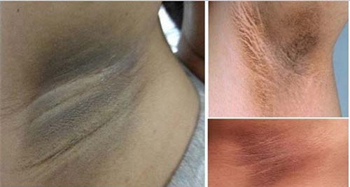 ban se bo ngay thoi quen nho long nach bang nhip sau khi doc bai viet nay - 3
