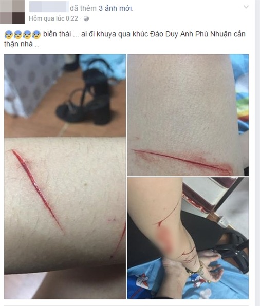 Thêm 1 cô gái trẻ ở Sài Gòn chia sẻ câu chuyện bị nhóm biến thái rạch đùi trong đêm - Ảnh 1.