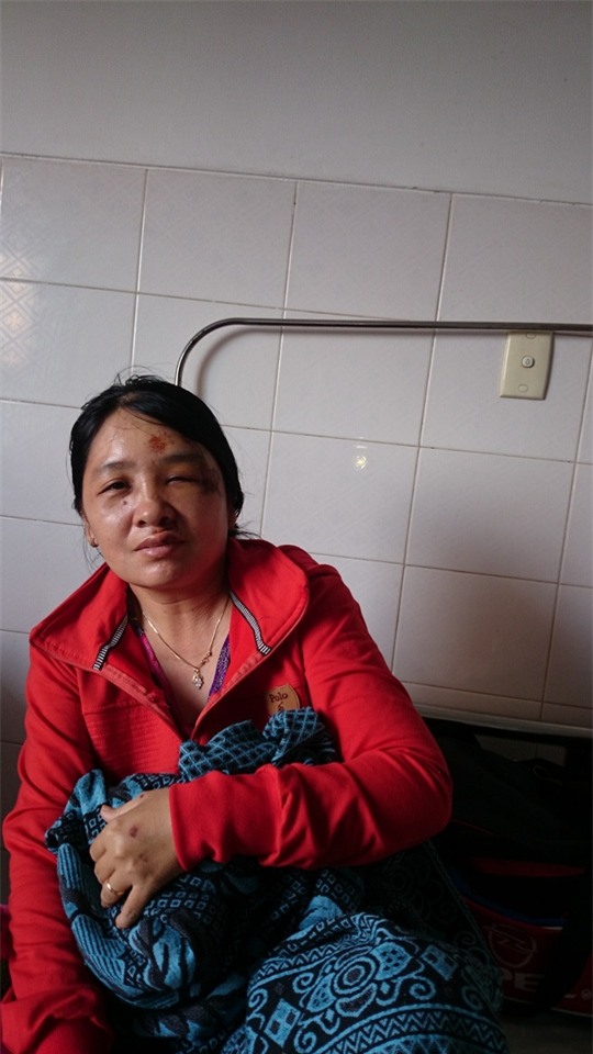 Bà Linh kể lại sự việc bị cướp.