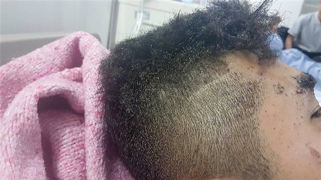 nổ xe khách giường nằm, nổ xe khách ở Bắc Ninh, nổ xe khách