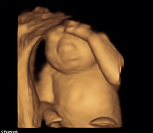 thai nhi di tat, me van quyet giu trong bung de lam viec khong ai ngo nay - 2