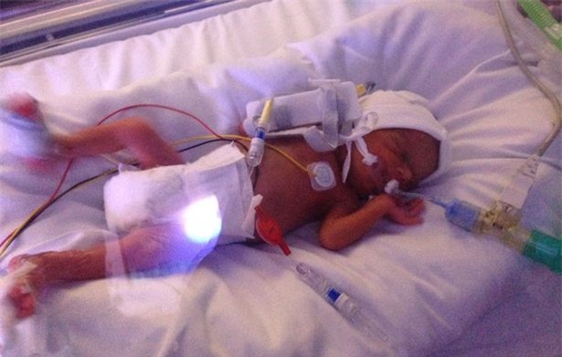 Vì một nụ hôn của chị gái, bé gái 2 tuổi bất ngờ được hồi sinh kỳ diệu - Ảnh 2.