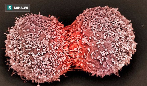 Ai cũng có tế bào ung thư trong cơ thể: 3 nguyên tắc vàng chặn đứng sự hình thành khối u - Ảnh 1.