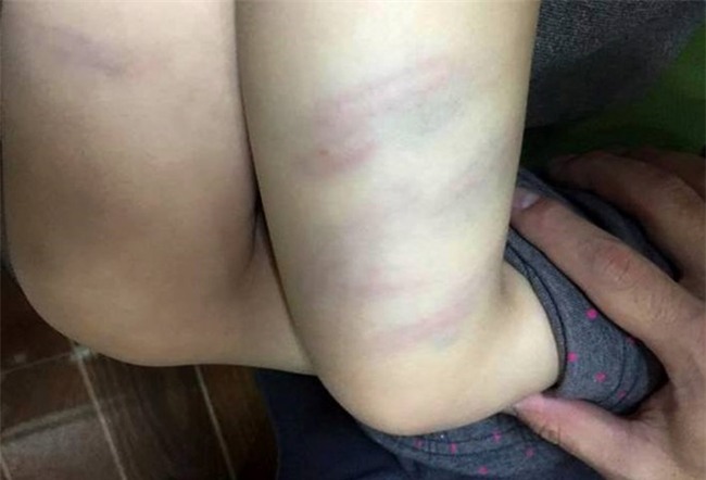 Sa thai co giao mam non dung dua danh tim dui tre hinh anh 1