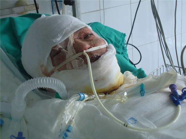 nhân ái, từ thiện, hiểm nghèo