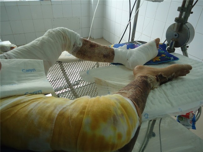 nhân ái, từ thiện, hiểm nghèo