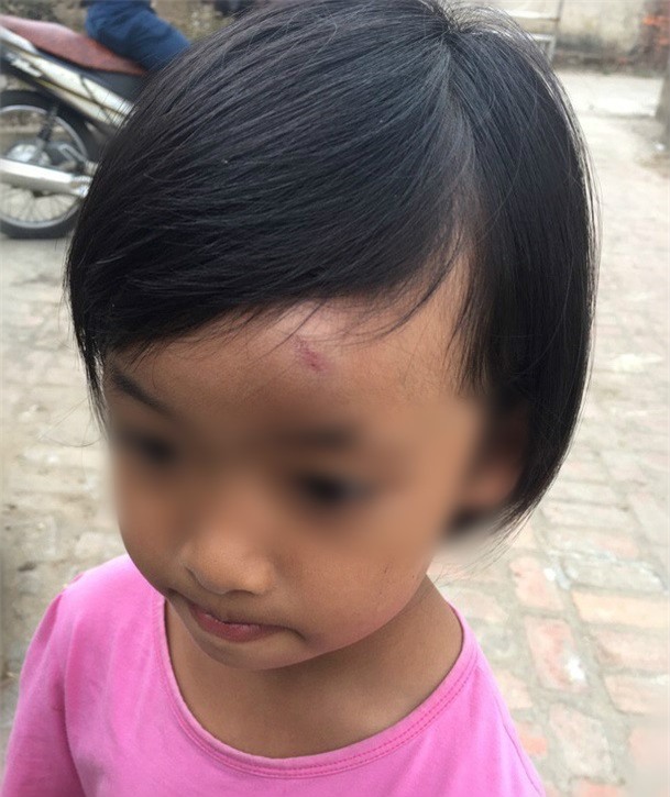 Trieu tap co giao mam non nem dep vao mat tre hinh anh 1