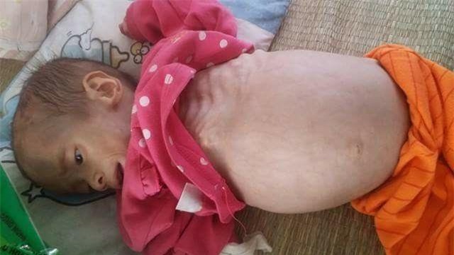 nhân ái, từ thiện, bệnh hiểm nghèo