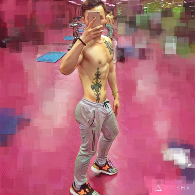 Con trai Việt và 3 ca phẫu thuật thẩm mỹ chỉ nghe thôi là đã sợ muốn ngất! - Ảnh 13.