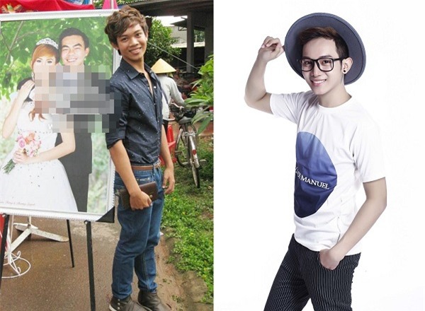 Con trai Việt và 3 ca phẫu thuật thẩm mỹ chỉ nghe thôi là đã sợ muốn ngất! - Ảnh 15.