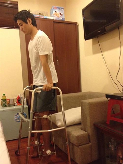 Con trai Việt và 3 ca phẫu thuật thẩm mỹ chỉ nghe thôi là đã sợ muốn ngất! - Ảnh 2.