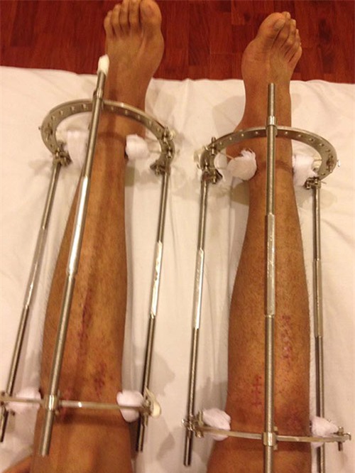 Con trai Việt và 3 ca phẫu thuật thẩm mỹ chỉ nghe thôi là đã sợ muốn ngất! - Ảnh 4.