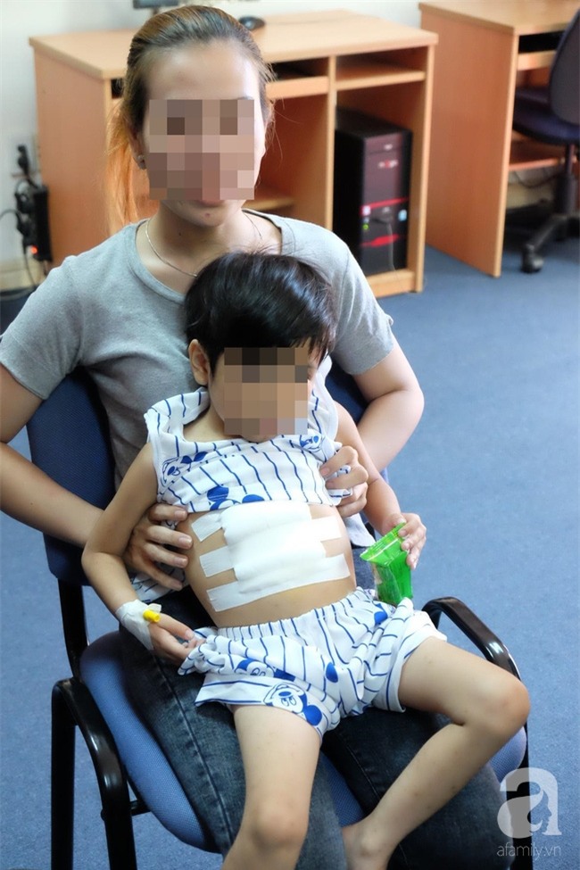 Phát hiện búi tóc dài hơn 40cm trong dạ dày bé trai mắc hội chứng “công chúa tóc dài” - Ảnh 2.