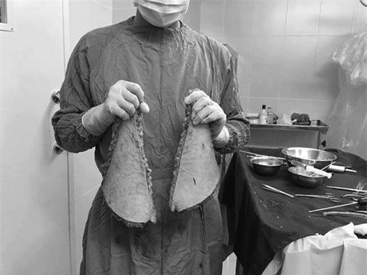 Xót xa mẹ 1 con đại phẫu làm đẹp hút mỡ bụng, nâng mũi, sửa mặt mặt để... dự đám cưới chồng cũ - Ảnh 2.