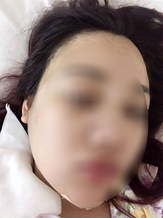 Xót xa mẹ 1 con đại phẫu làm đẹp hút mỡ bụng, nâng mũi, sửa mặt mặt để... dự đám cưới chồng cũ - Ảnh 3.