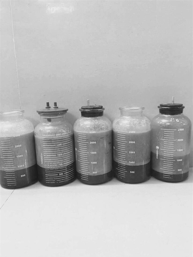 Xót xa mẹ 1 con đại phẫu làm đẹp hút mỡ bụng, nâng mũi, sửa mặt mặt để... dự đám cưới chồng cũ - Ảnh 4.