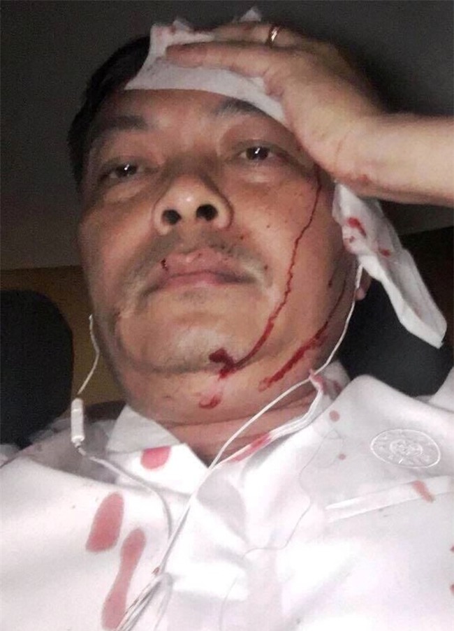 Giam doc nhan su ca phe Trung Nguyen bi danh o Sai Gon hinh anh 1