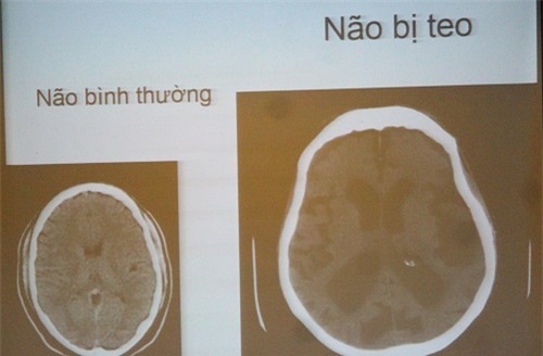 hay cho dang may rau xem hinh anh duoi day, ho dang say chen ruou se phai dat xuong ngay - 1