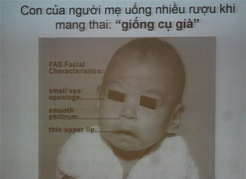 hay cho dang may rau xem hinh anh duoi day, ho dang say chen ruou se phai dat xuong ngay - 4