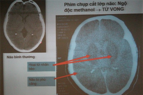 hay cho dang may rau xem hinh anh duoi day, ho dang say chen ruou se phai dat xuong ngay - 5