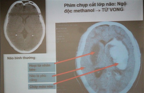 hay cho dang may rau xem hinh anh duoi day, ho dang say chen ruou se phai dat xuong ngay - 6