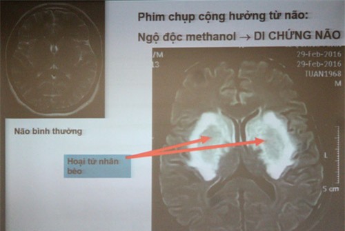 hay cho dang may rau xem hinh anh duoi day, ho dang say chen ruou se phai dat xuong ngay - 7