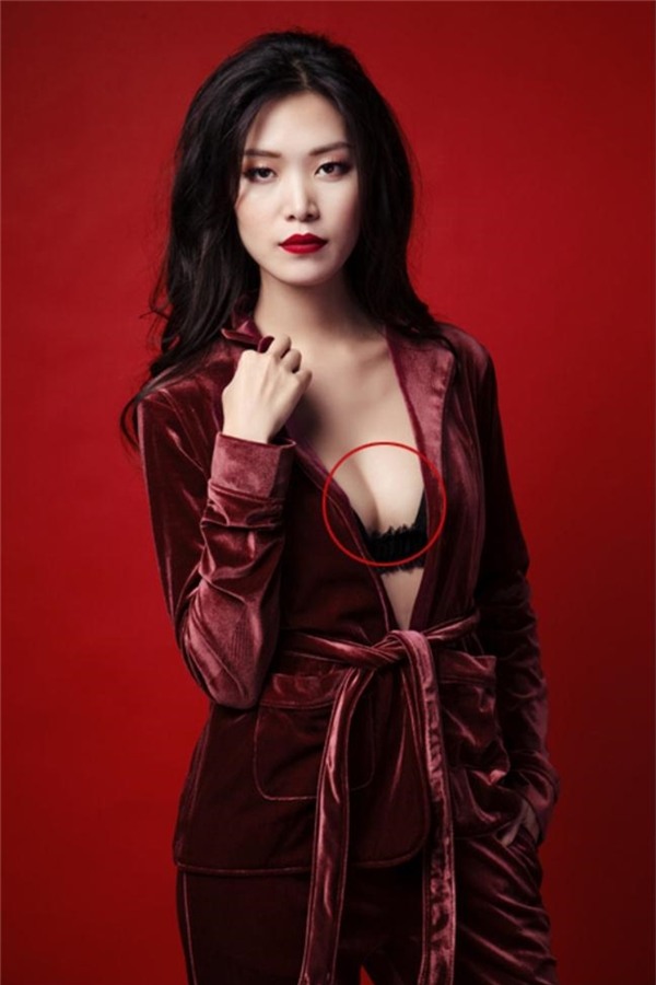 Vòng một của Hoa hậu Thùy Dung trông mấp mô bất thường với bên cao, bên thấp.