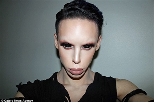 "het hon" voi anh chang chi hang ti dong de phau thuat thanh di nhan - 1