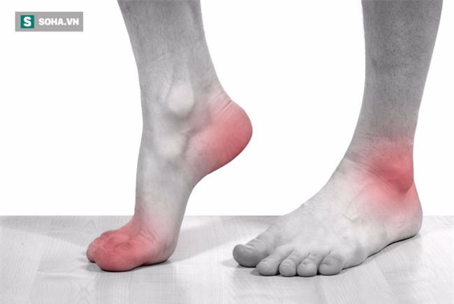 Lời khuyên bác sĩ: Chữa khỏi bệnh gout không phải thuốc, mà do bí quyết ĂN ít, ỘP nhiều - Ảnh 1.